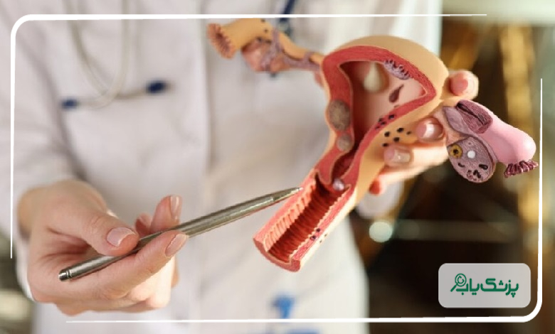 هزینه خدمات بهترین دکتر زگیل تناسلی در شهریار
