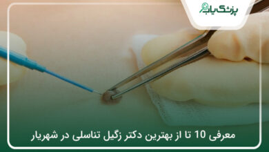 بهترین دکتر زگیل تناسلی در شهریار