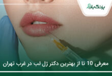 بهترین دکتر ژل لب در غرب تهران