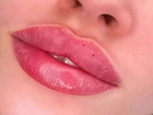 کلینیک زیبایی آذر قنبری