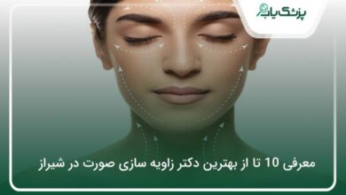 بهترین دکتر زاویه سازی صورت در شیراز