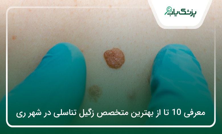 بهترین متخصص زگیل تناسلی در شهر ری