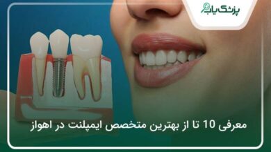 بهترین متخصص ایمپلنت در اهواز
