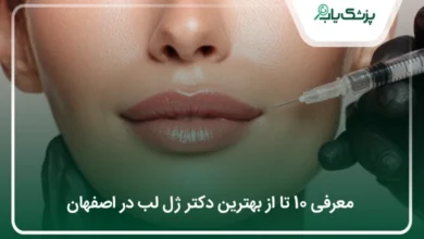 بهترین دکتر ژل لب در اصفهان
