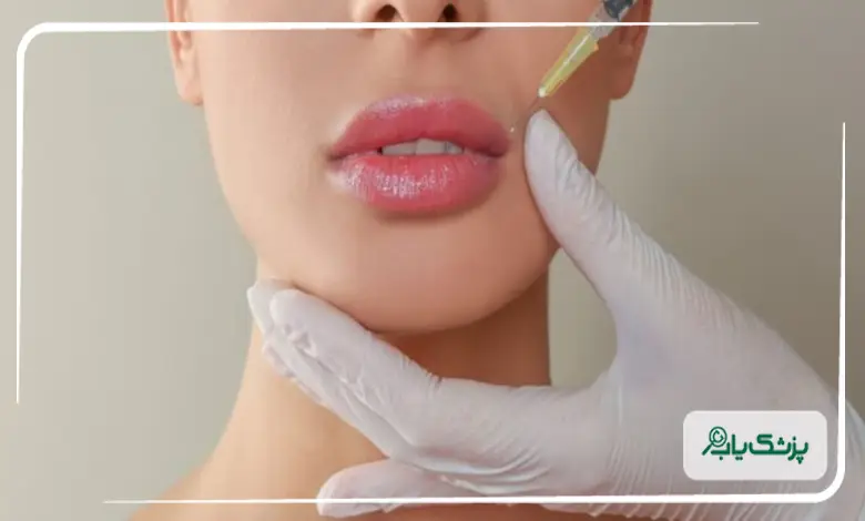 خصوصیات بهترین دکتر ژل لب در اصفهان