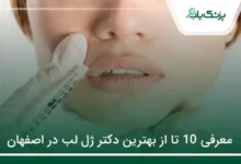 بهترین دکتر ژل لب در اصفهان