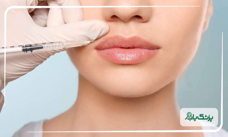 ویژگی‌های اصلی بهترین دکتر تزریق ژل لب شیراز
