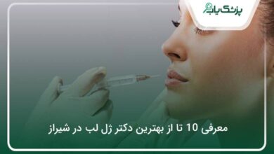 بهترین دکتر ژل لب در شیراز