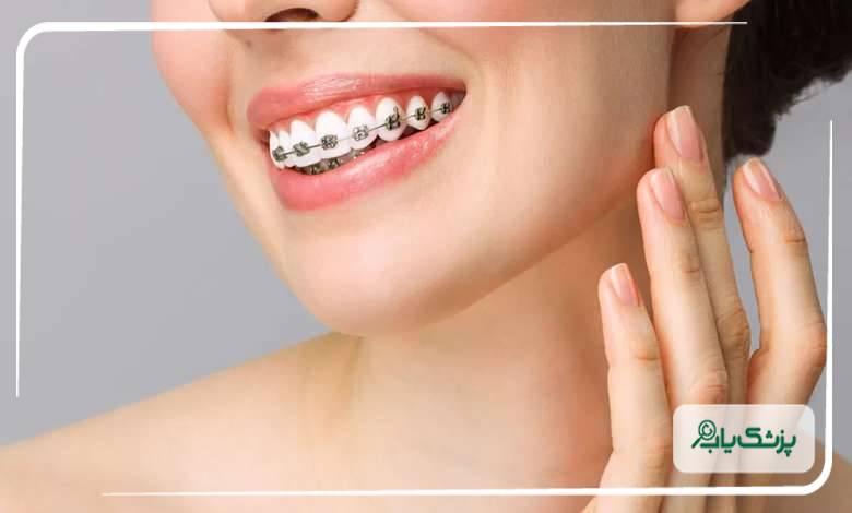 عوامل تاثیرگذار در هزینههای ارتودنسی توسط متخصصان