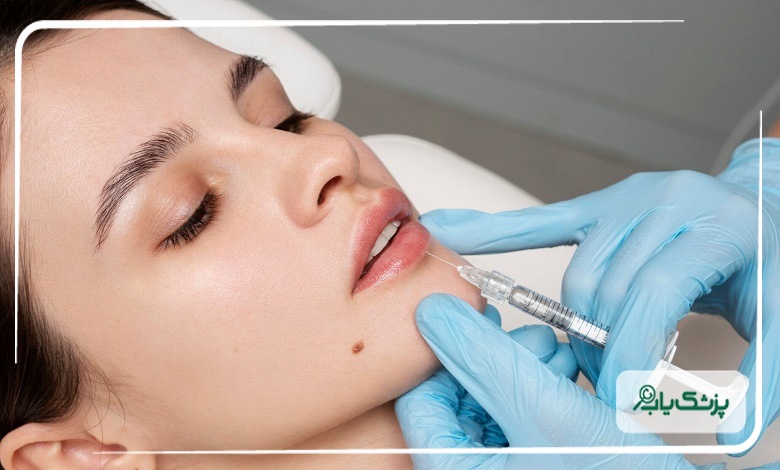 مزایای انتخاب بهترین دکتر تزریق ژل در اصفهان