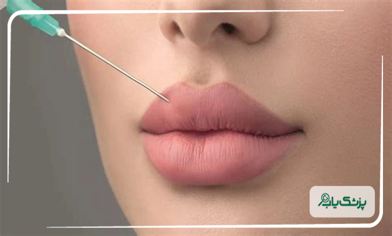 علائم عفونت بعد از تزریق ژل؛ راه های پیشگیری از عوارض