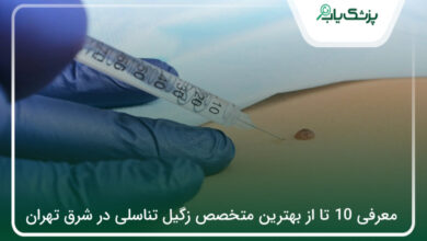 بهترین متخصص زگیل تناسلی در شرق تهران