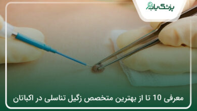 بهترین متخصص زگیل تناسلی در اکباتان