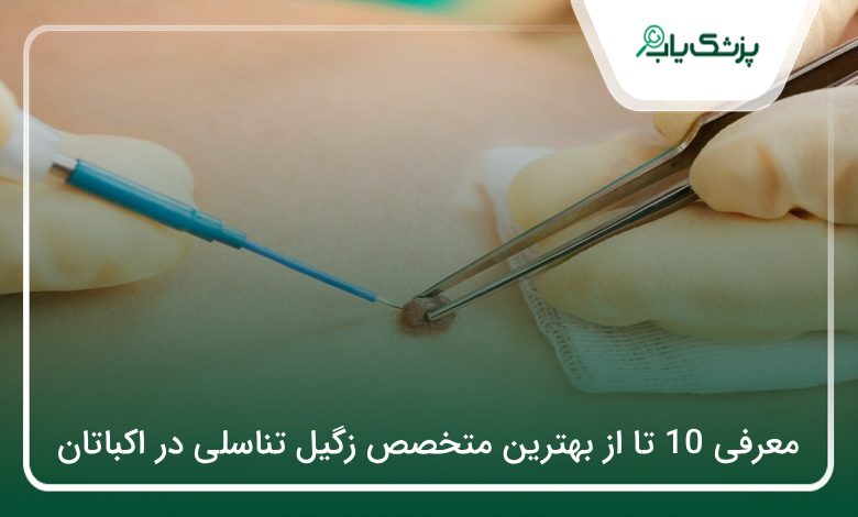 بهترین متخصص زگیل تناسلی در اکباتان