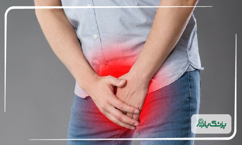 مراحل درمان زگیل تناسلی