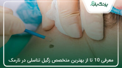 بهترین متخصص زگیل تناسلی در نارمک