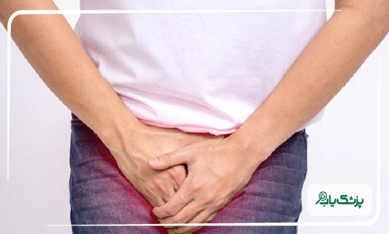 اقدامات درمانی بهترین متخصص زگیل تناسلی در صادقیه