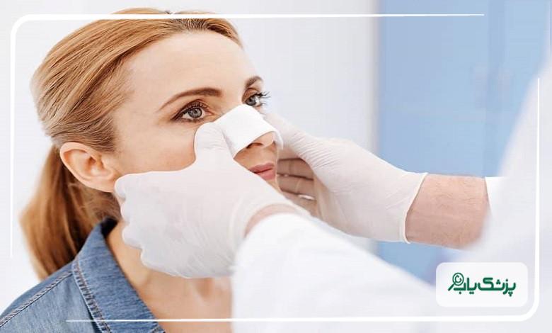 مراقبت های بعد از جراحی بینی طبیعی