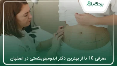 بهترین دکتر ابدومینوپلاستی در اصفهان