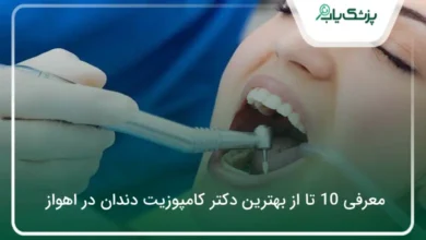 بهترین دکتر کامپوزیت دندان در اهواز