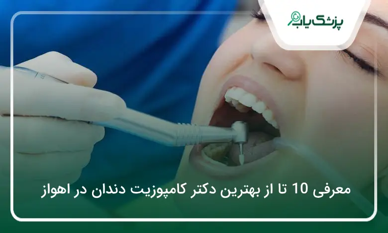 بهترین دکتر کامپوزیت دندان در اهواز