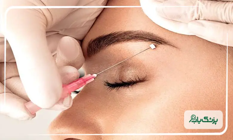 بهترین روش لیفت ابرو برای فرم دهی صورت کدام است؟