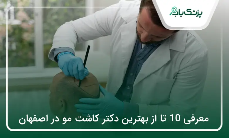 بهترین دکتر کاشت مو در اصفهان