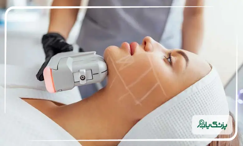 چرا انتخاب بهترین دکتر هایفوتراپی اصفهان اهمیت دارد؟