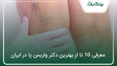 بهترین دکتر واریس پا در ایران