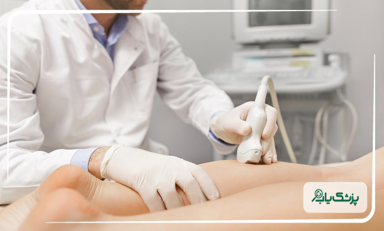 راهکارهای کاهش علائم واریس