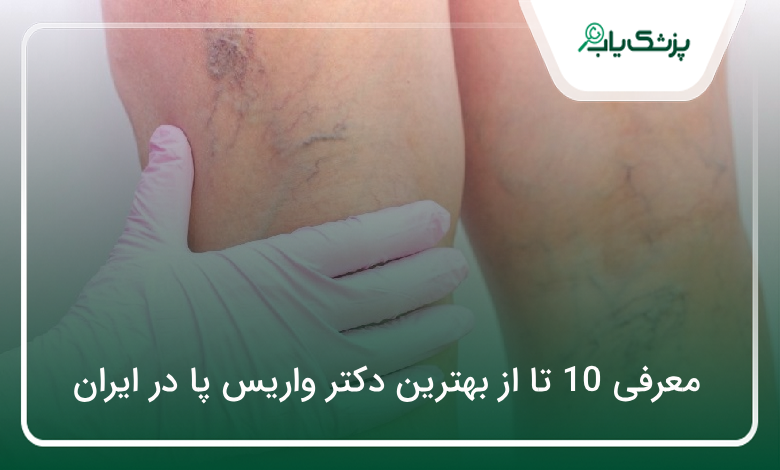 بهترین دکتر واریس پا در ایران