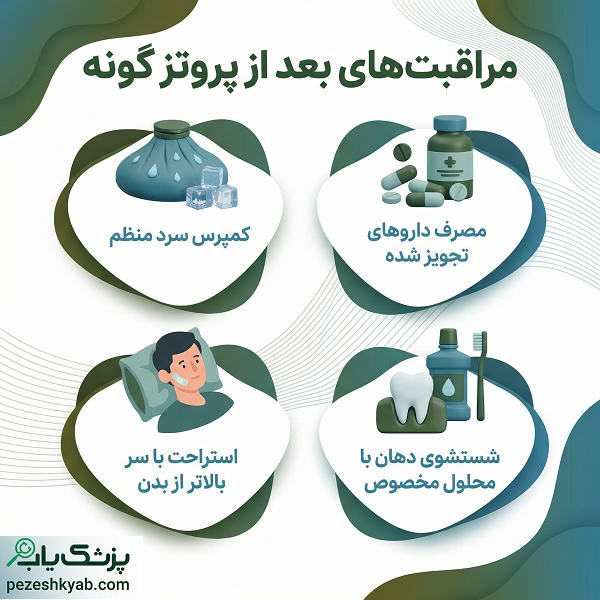 مراقبت های بعد از پروتز گونه