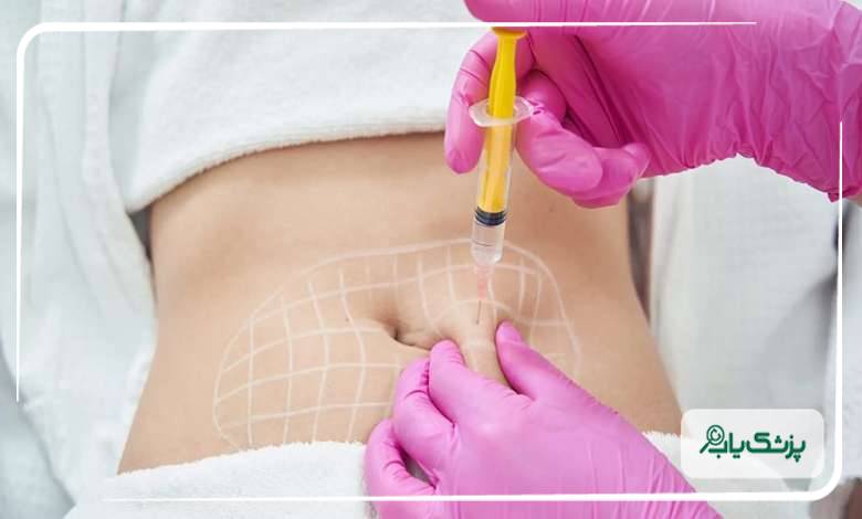 خدمات تخصصی بهترین دکتر فیلر بادی در پرند