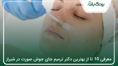 بهترین دکتر ترمیم جای جوش صورت در شیراز