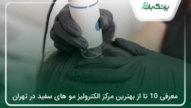 بهترین مرکز الکترولیز مو های سفید در تهران