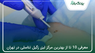 بهترین مرکز لیزر زگیل تناسلی در تهران