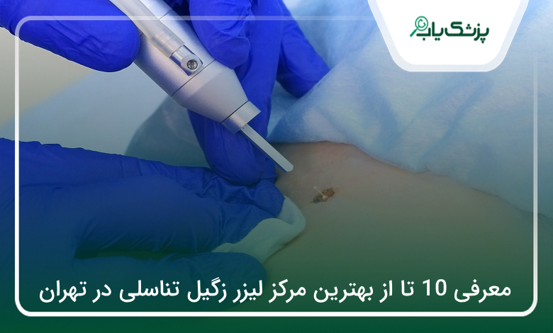 بهترین مرکز لیزر زگیل تناسلی در تهران