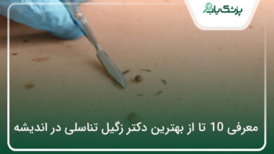 بهترین دکتر زگیل تناسلی در اندیشه