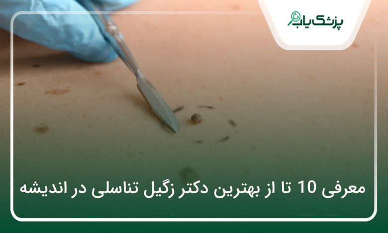 بهترین دکتر زگیل تناسلی در اندیشه