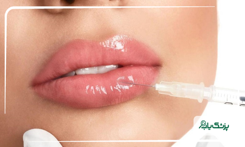 راهنمای انتخاب پزشک متخصص تزریق ژل لب