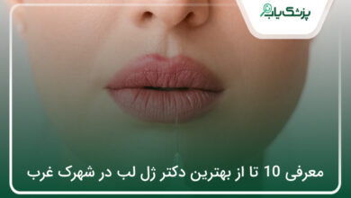 بهترین دکتر ژل لب در شهرک غرب