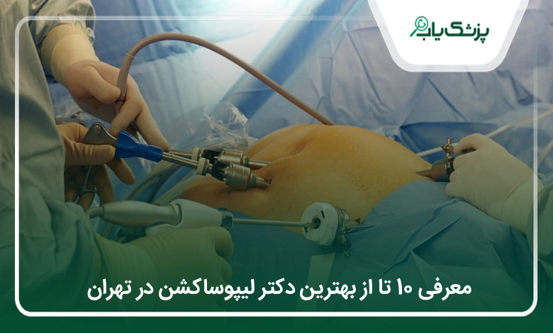 بهترین دکتر لیپوساکشن در تهران