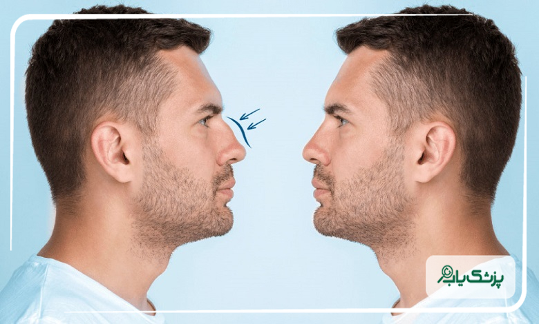جراحی همزمان زیبایی و انحراف بینی و پولیپ