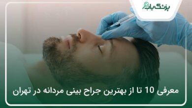 بهترین جراح بینی مردانه در تهران