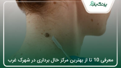 بهترین مرکز خال برداری در شهرک غرب