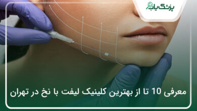 بهترین کلینیک لیفت با نخ در تهران