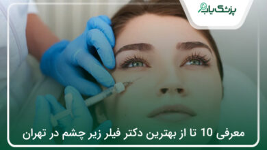 بهترین دکتر فیلر زیر چشم در تهران