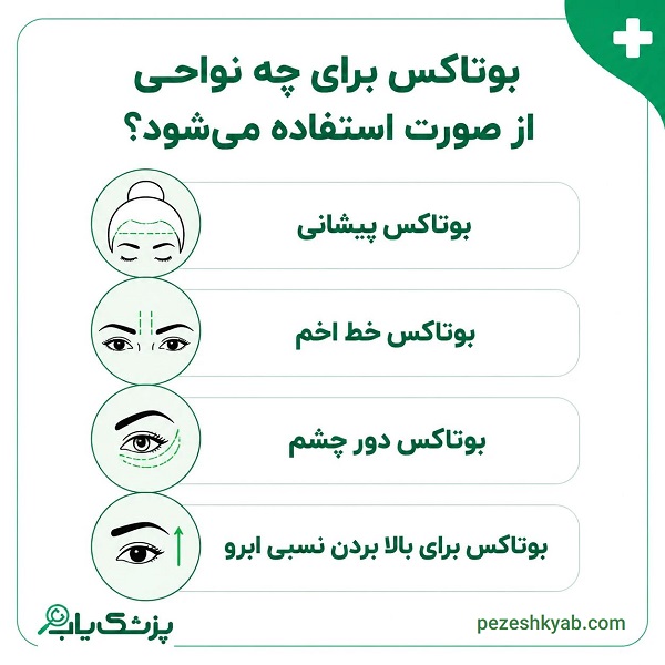 بوتاکس برای چه نواحی از صورت استفاده میشود؟