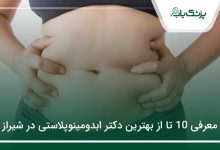 بهترین دکتر ابدومینوپلاستی در شیراز