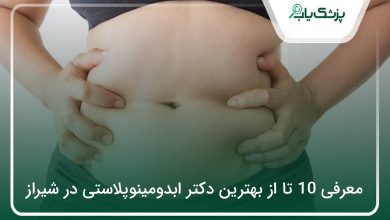 بهترین دکتر ابدومینوپلاستی در شیراز